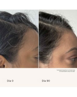 Living Proof México | Scalp Care Density Serum 2