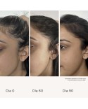 Living Proof México | Scalp Care Density Serum